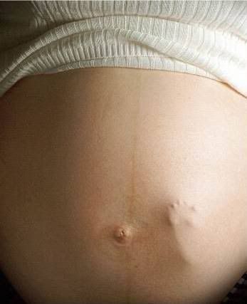 Pregnancy System Pregnant