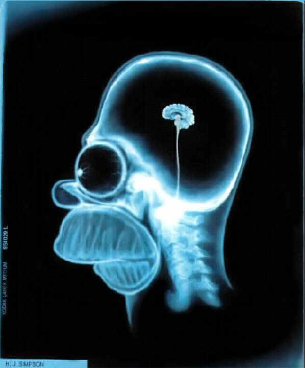 Simpson-brain-doh.jpg